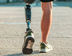 patient needing Phantom Limb Syndrome