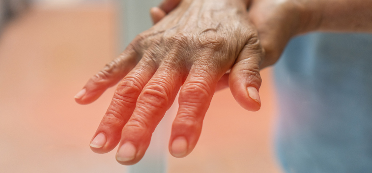 patient experiencing Stabbing & Burning Pain and in need of the neuropathy treatment protocol at Well Being Neuropathy Relief Center in Roseville