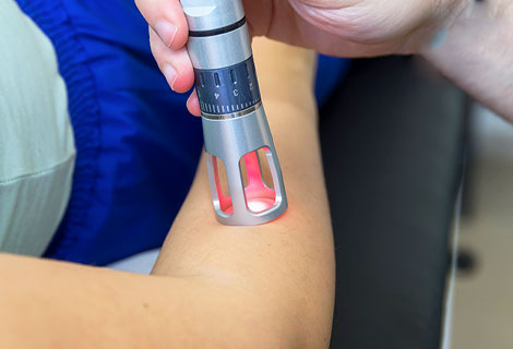 cold Laser therapy for neuropathy relief