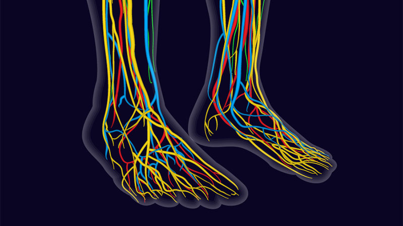 What is Peripheral Neuropathy?