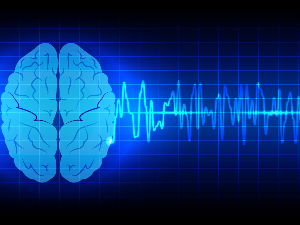 functional-neurology.jpg