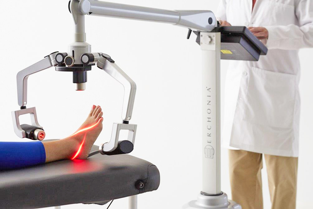 low level laser therapy for plantar fasciitis